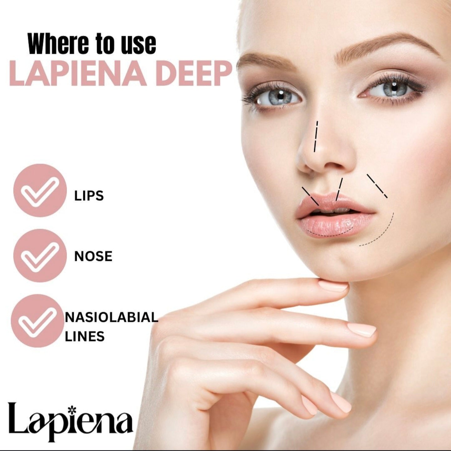Dermal Filler with HCCL